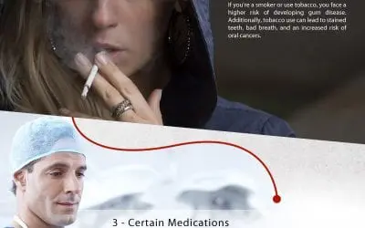 4 Common Causes of Gum Disease