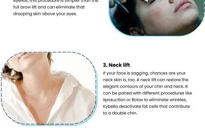 5 Ideas for Cosmetic Enhancements