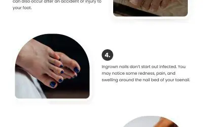 10 Things You Should Know About Ingrown Toenails