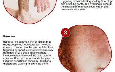 5 Benefits of Using Soap for Specific Skin Types