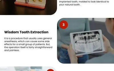 5 Common Dental Procedures