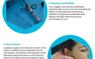 4 Things to Know Before Your Neck Lift Procedure