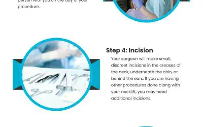 7 Steps of a Neck Lift Procedure
