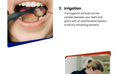 4 Easy Steps of  Periodontal Maintenance