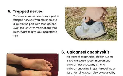 10 Causes of Heel Pain