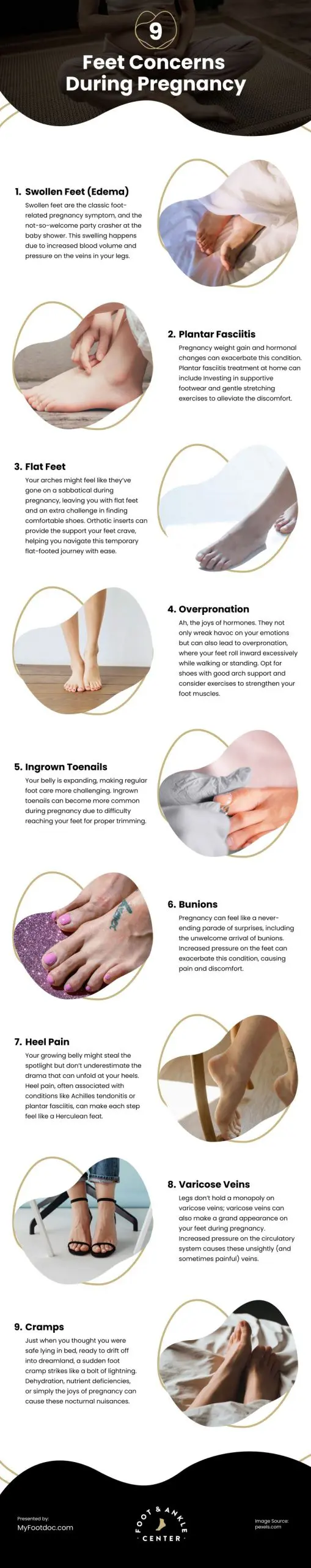 9 Feet Concerns During Pregnancy Infographic