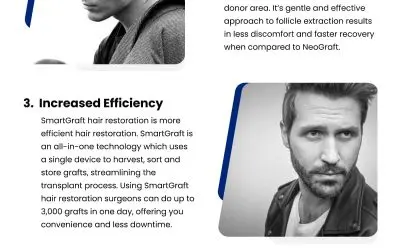 5 SmartGraft Hair Restoration Benefits