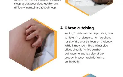 7 Physical Signs of Heroin Addiction