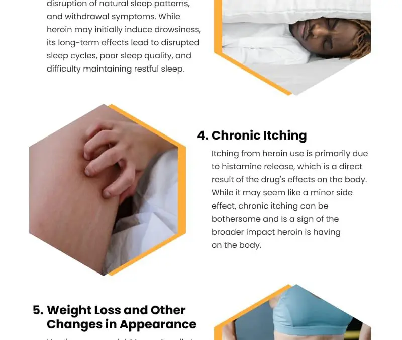 7 Physical Signs of Heroin Addiction