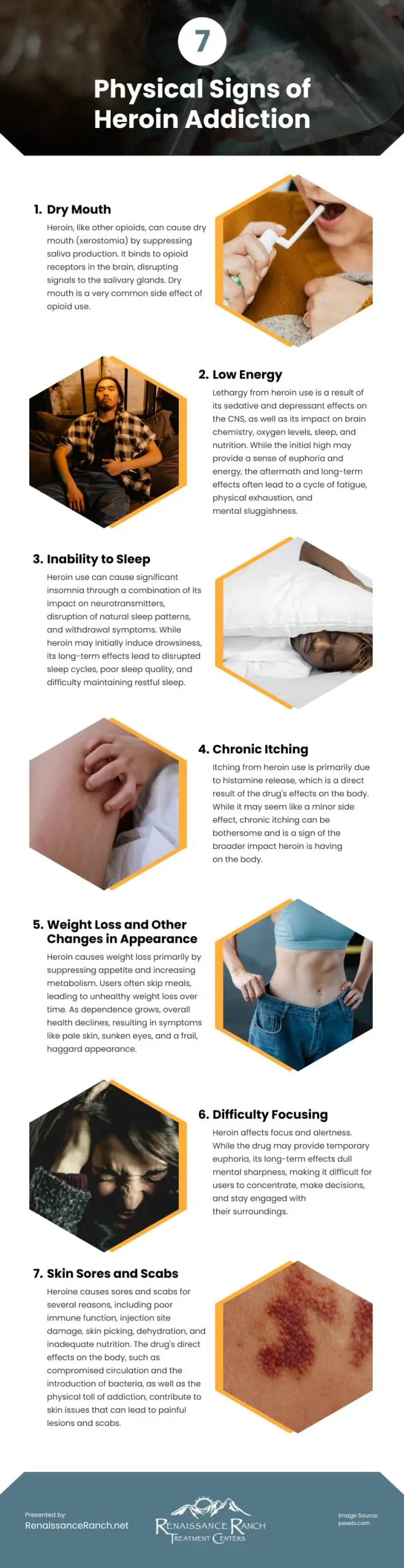 7 Physical Signs of Heroin Addiction Infographic