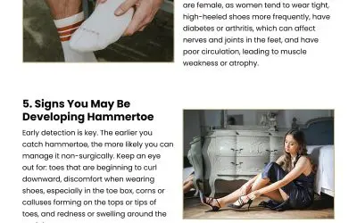 8 Insights on Family Connections to Hammertoe