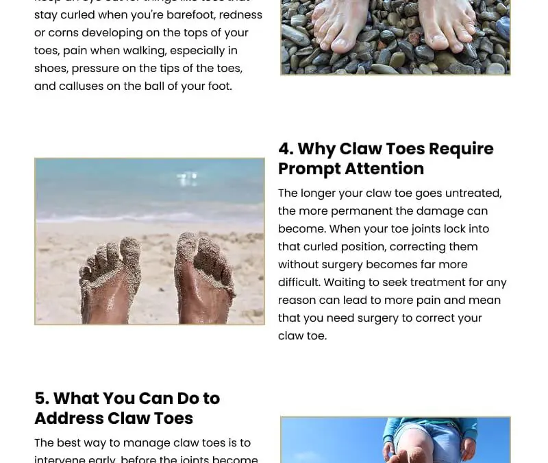 7 Facts About Claw Toes