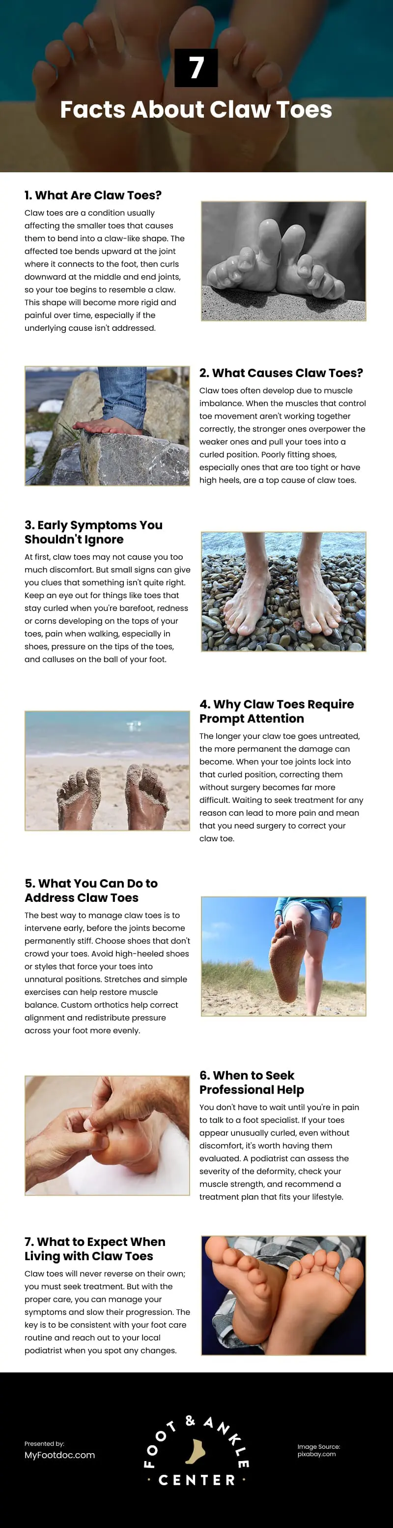 7 Facts About Claw Toes Infographic 7 Facts About Claw Toes Infographic
