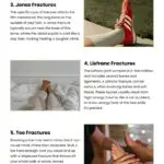 7 Types of Foot Fractures 7 Types of Foot Fractures Infographic