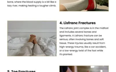 7 Types of Foot Fractures