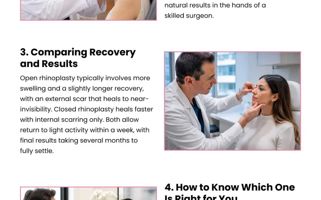 5 Facts About Open and Closed Rhinoplasty