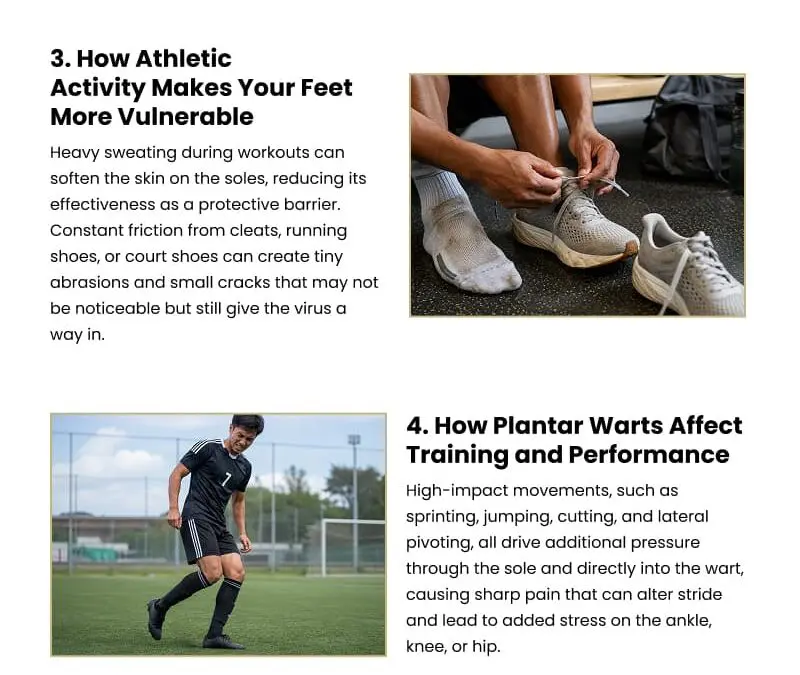 6 Reasons Plantar Warts Love Active Feet