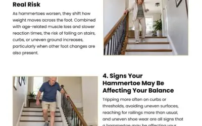 6 Ways Hammertoes Affect Balance as You Age