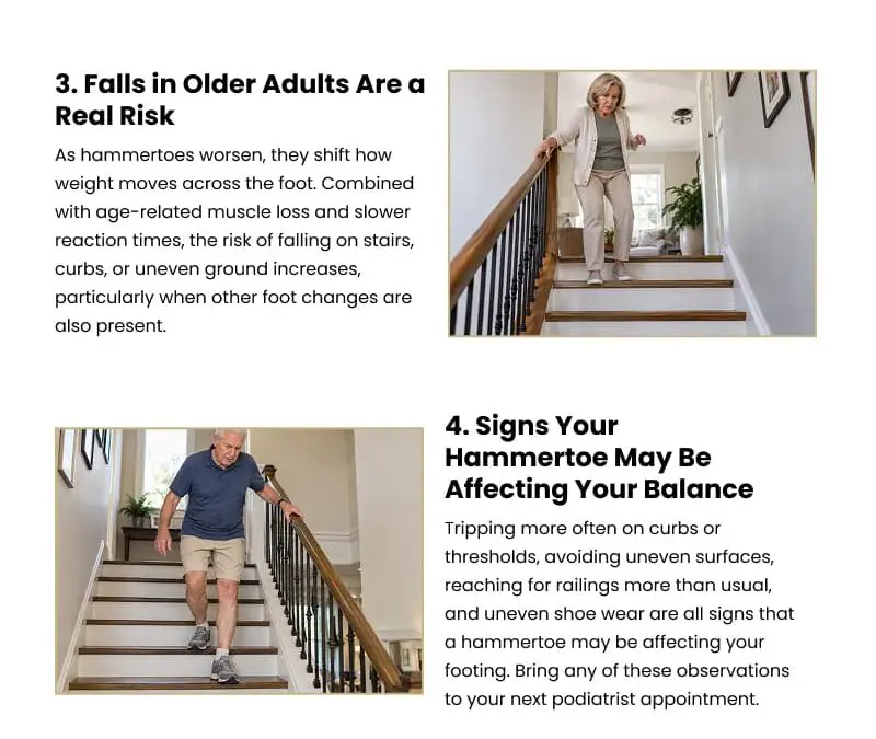 6 Ways Hammertoes Affect Balance as You Age