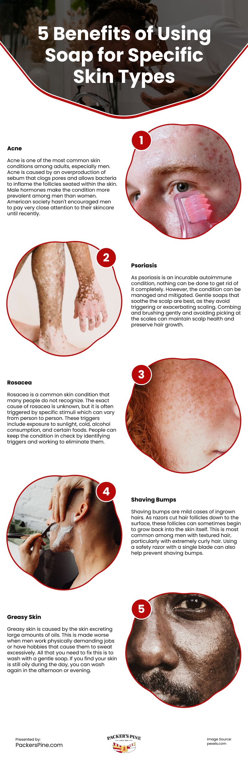 5 Benefits of Using Soap for Specific Skin Types Infographic