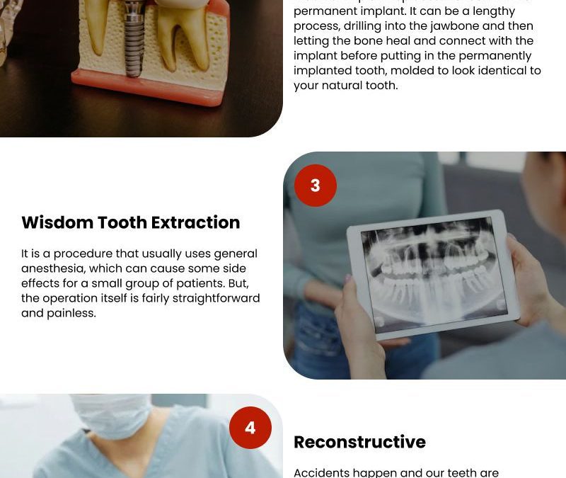 5 Common Dental Procedures