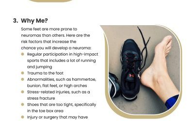 5 Facts on Foot Neuroma